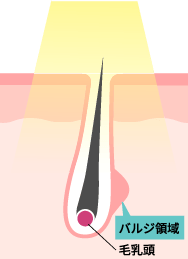 エステ脱帽のイメージ図